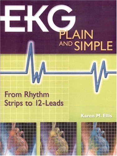 EKG Plain and Simple : From Rhythm Strips to 12-Leads
