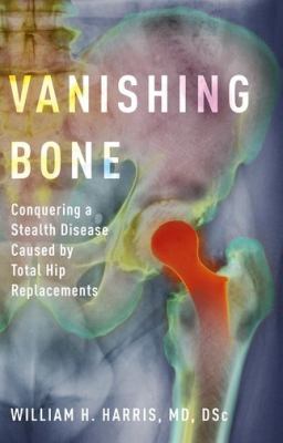Vanishing Bone : Conquering a Stealth Disease Caused by Total Hip Replacements