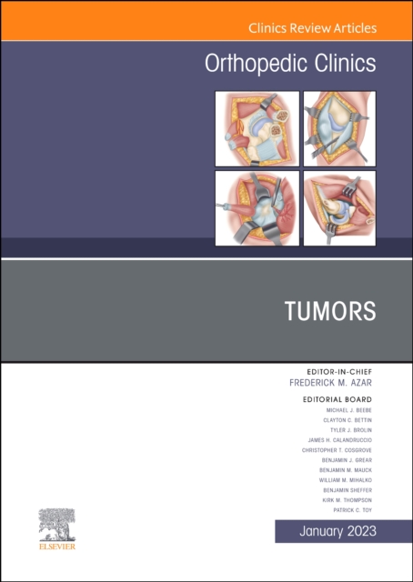 Tumors, an Issue of Orthopedic Clinics