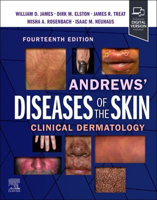 Andrews' Diseases of the Skin : Clinical Dermatology