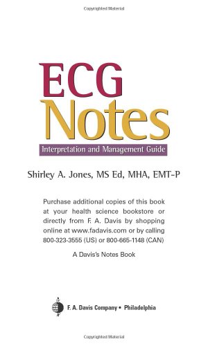 ECG Notes : Interpretation and Management Guide