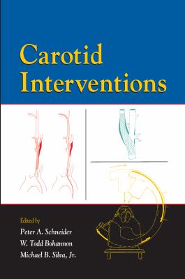 Carotid Interventions
