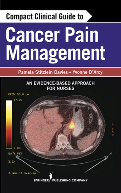 Compact Clinical Guide to Cancer Pain Management : An Evidence-Based Approach for Nurses