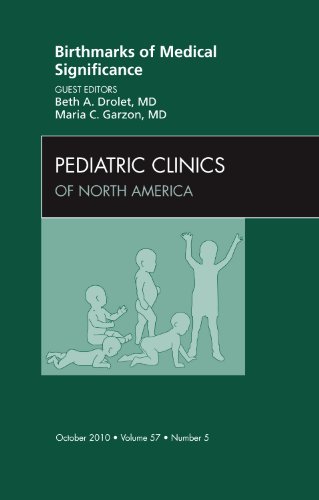 Birthmarks of Medical Significance, an Issue of Pediatric Clinics