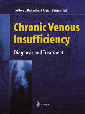 Chronic Venous Insufficiency : Diagnosis and Treatment