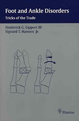 Foot and Ankle Disorders : Tricks of the Trade