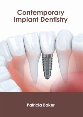 Contemporary Implant Dentistry