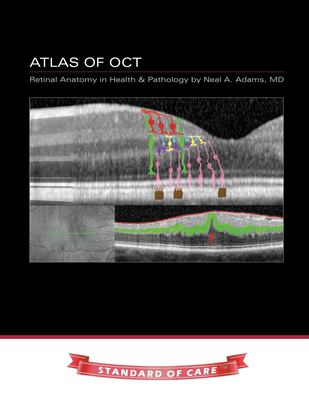 Atlas of OCT : Retinal Anatomy in Health & Pathology