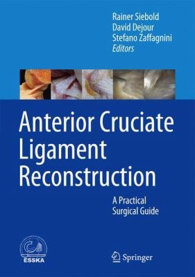 Arthroscopic Anterior Cruciate Ligament Reconstruction : A Practical Surgical Guide