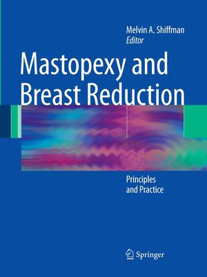 Mastopexy and Breast Reduction : Principles and Practice